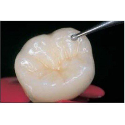 Fresa de Diamante NTI Esférica